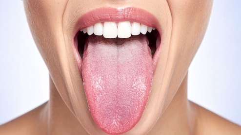 जीभ का रंग बयां करेगा कैसी है आपकी सेहत, इन बिमारियों का हो सकता है संकेत