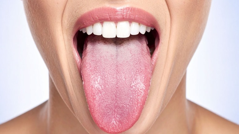 जीभ का रंग बयां करेगा कैसी है आपकी सेहत, इन बिमारियों का हो सकता है संकेत
