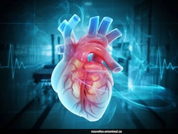 Even Small Plaque Build-Up Raises Heart Attack Risk For Women: Study