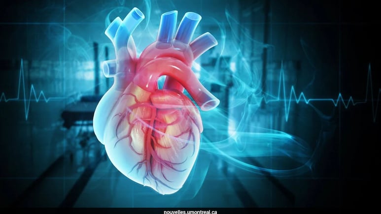 Even Small Plaque Build-Up Raises Heart Attack Risk For Women: Study