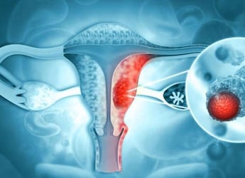 India's First Indigenous HPV Test Validated For Cervical Cancer Detection