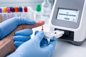 फिंगरस्टिक टेस्ट से सिर्फ एक घंटे में चल जाएगा Hepatitis-B का पता, क्या अब नहीं लगाने पड़ेंगे लैब के चक्कर?