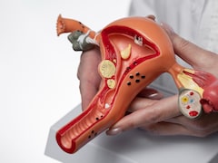 What Is An At-Home Cervical Cancer Screening Test? Are They Easy To Use And Reliable?