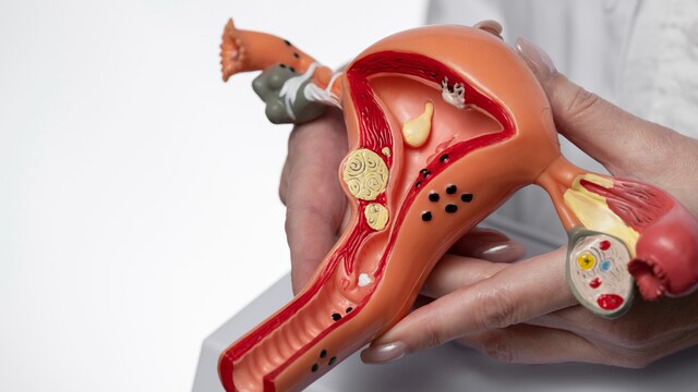 The at-home cervical cancer screening test can be used for early detection