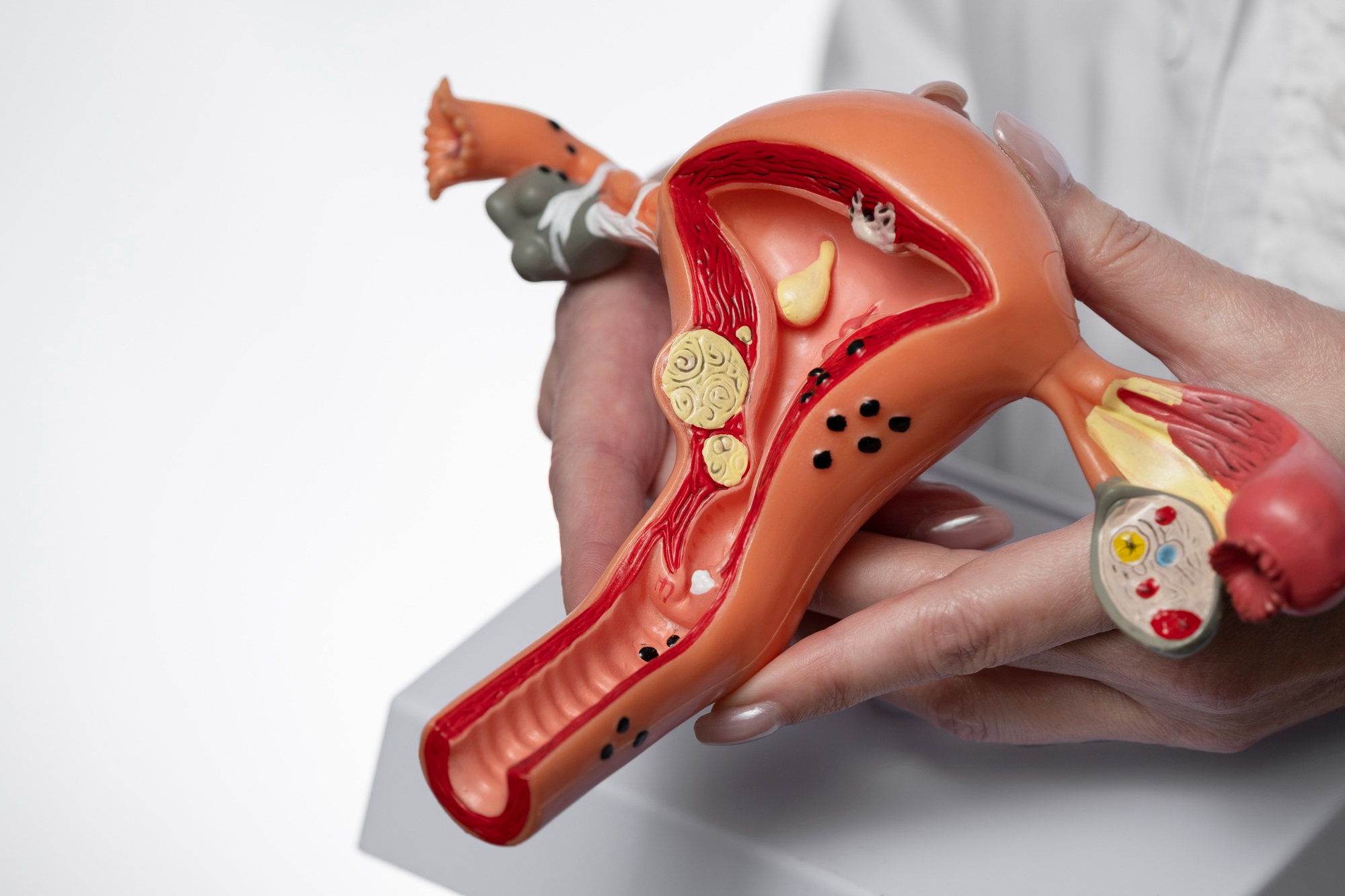The at-home cervical cancer screening test can be used for early detection