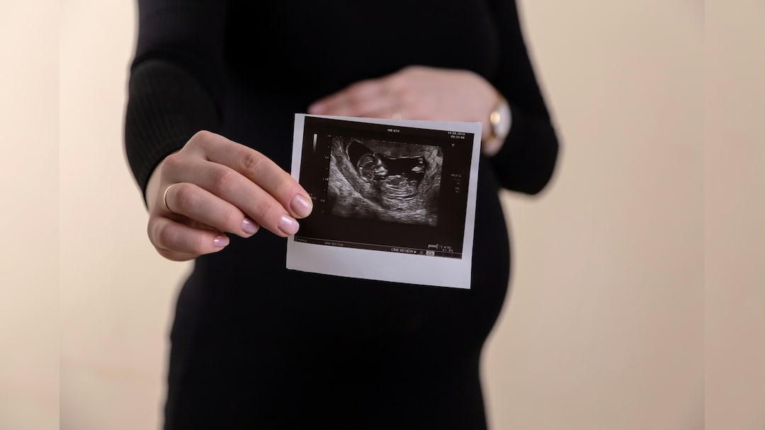 Gaudium IVF IPO Opens Feb. 20: Check Price Band, GMP And Other Details