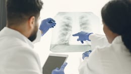 New Pulmonary Embolism Guidelines Stress On Early Diagnosis, Care On Global Level