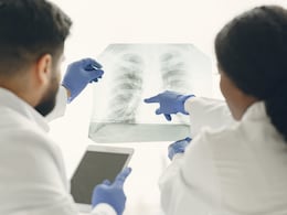 New Pulmonary Embolism Guidelines Stress On Early Diagnosis, Care On Global Level