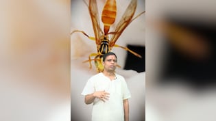 गंजापन कर देगा दूर ततैया का छत्ता, आचार्य बालकृष्ण से जानें कैसे करना होगा इस्तेमाल