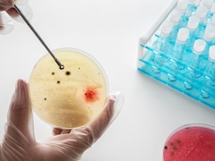 Meghalaya Issues Public Health Advisory After Suspected Meningococcal Cases at Army Training Centre