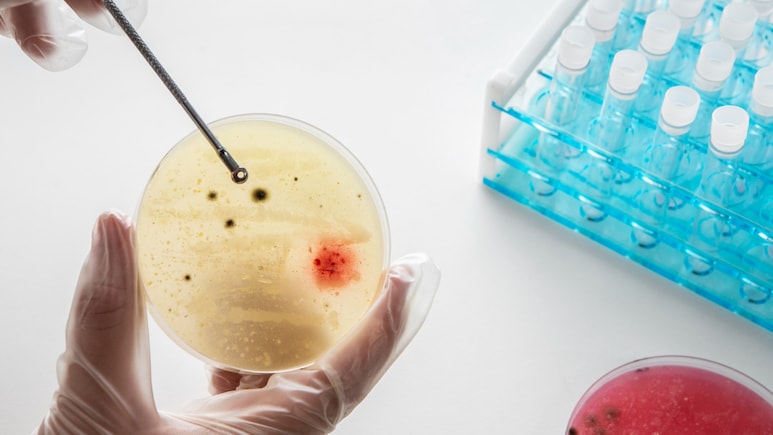 Meghalaya Issues Public Health Advisory After Suspected Meningococcal Cases at Army Training Centre