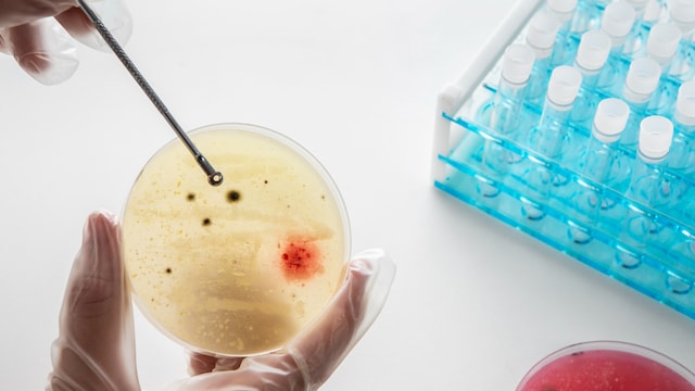 Testing for viral meningitis is done through cerebrospinal fluid screenings