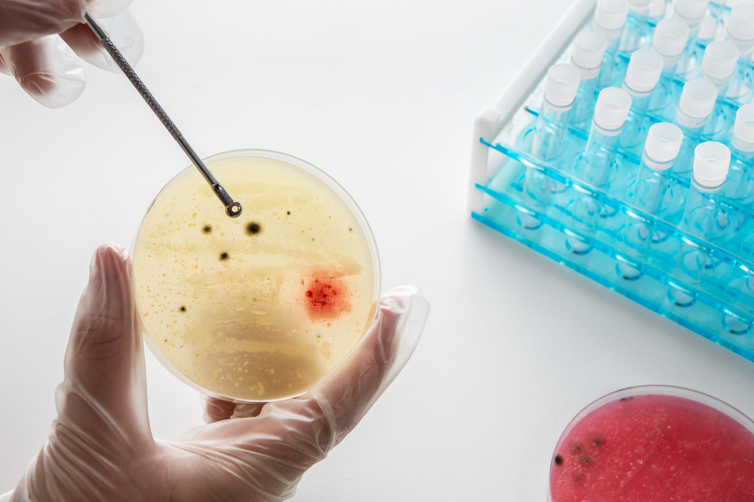 Testing for viral meningitis is done through cerebrospinal fluid screenings