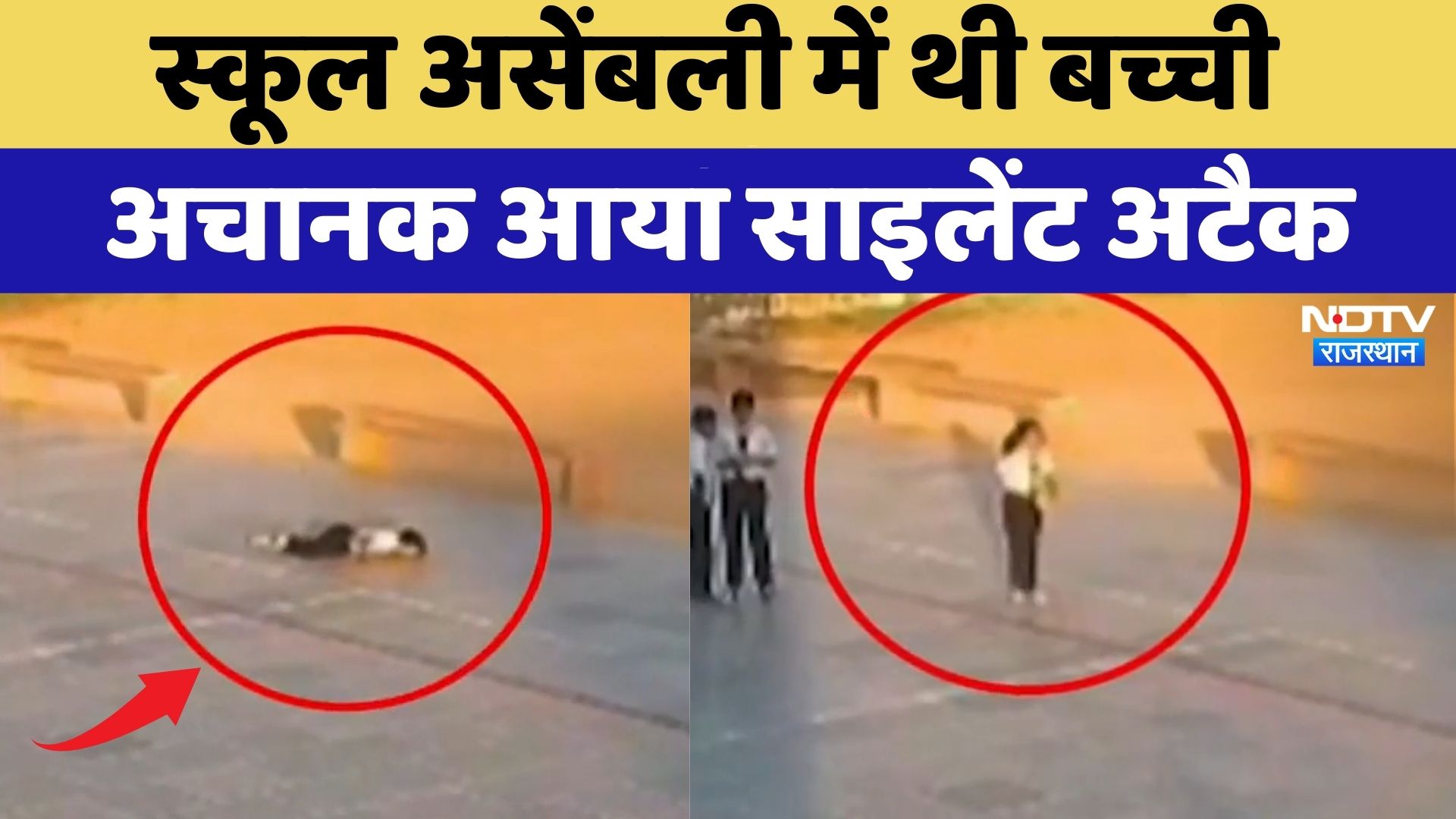 Nagaur Heart Attack Case: School Assembly में अचानक गिरी बच्ची की हुई मौत | Top News