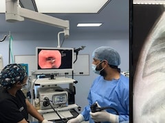 बच्ची ने निगल लिया था लोहे का हुक, जान पर आफत, फिर सरकारी डॉक्टरों ने बिना ऑपरेशन कर दिया कमाल!