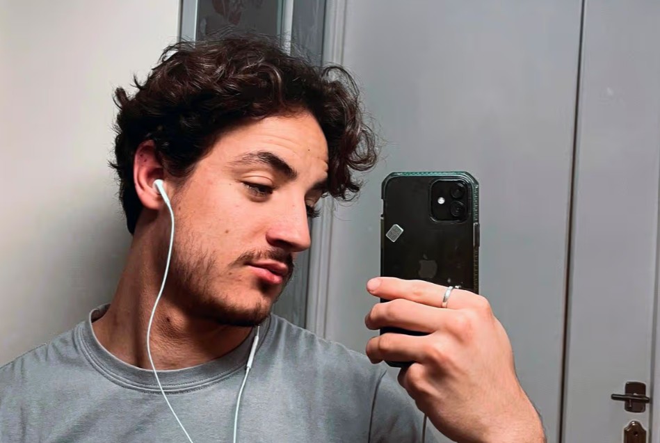 24 साल के लड़के को नहीं आती थी दाढ़ी, करवा ली डेढ़ लाख में सर्जरी, बाल तो आए लेकिन...