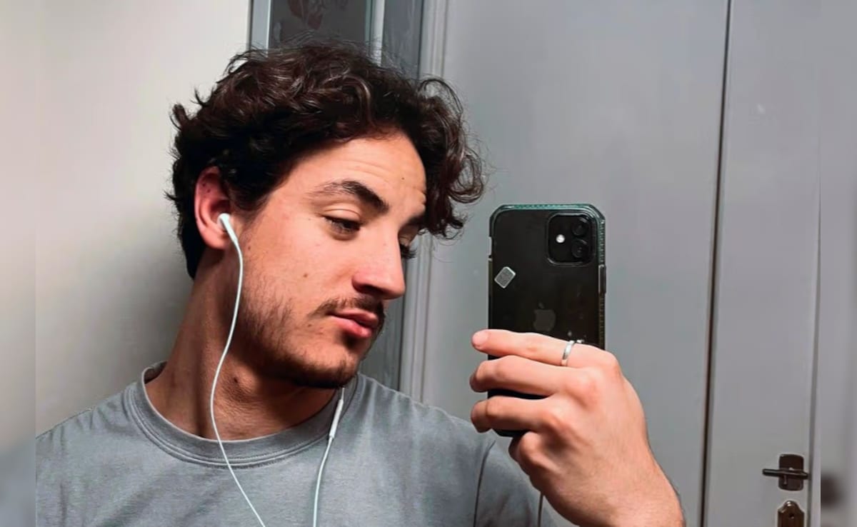 24 साल के लड़के को नहीं आती थी दाढ़ी, करवा ली डेढ़ लाख में सर्जरी, बाल तो आए लेकिन...