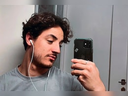 24 साल के लड़के को नहीं आती थी दाढ़ी, करवा ली डेढ़ लाख में सर्जरी, बाल तो आए लेकिन...