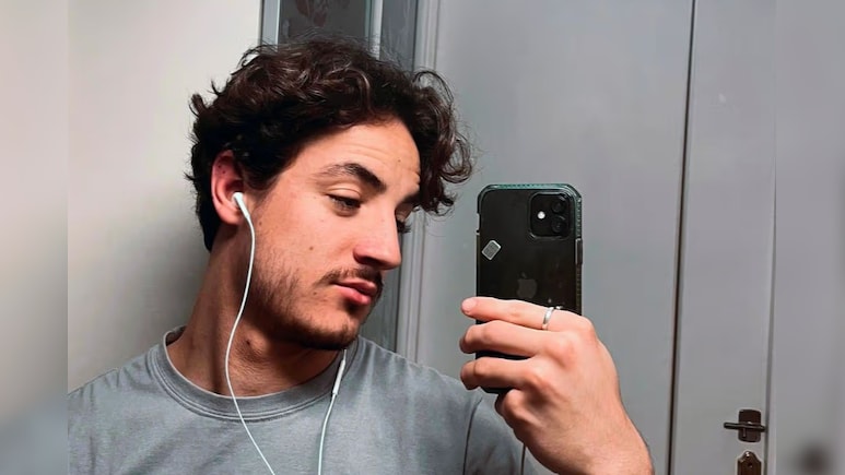 24 साल के लड़के को नहीं आती थी दाढ़ी, करवा ली डेढ़ लाख में सर्जरी, बाल तो आए लेकिन...