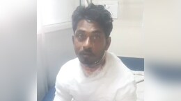 EMI पर खरीदी टैक्सी गाड़ी, बार-बार खराबी से परेशान युवक ने खुद को लगाई आग, गंभीर रूप से झुलसा