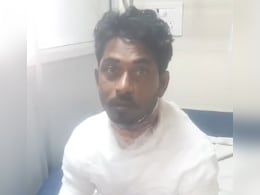 EMI पर खरीदी टैक्सी गाड़ी, बार-बार खराबी से परेशान युवक ने खुद को लगाई आग, गंभीर रूप से झुलसा