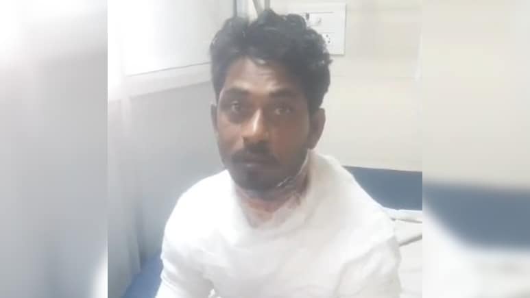 EMI पर खरीदी महिंद्रा टैक्सी, बार-बार खराबी से परेशान युवक ने खुद को लगाई आग, गंभीर झुलसा