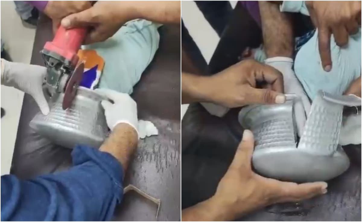 VIDEO: बर्तन में फंसा बच्‍चे का सिर, चीखता-चिल्लाता रहा मासूम, घंटों बाद डॉक्टरों ने यूं बचाई जान