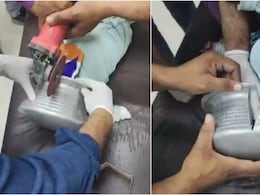 VIDEO: बर्तन में फंसा बच्&zwj;चे का सिर, चीखता-चिल्लाता रहा मासूम, घंटों बाद डॉक्टरों ने यूं बचाई जान