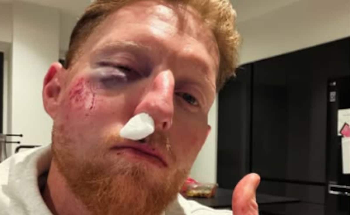 Ben Stokes Suffers Serious Injury After Being Struck By Ball During Training