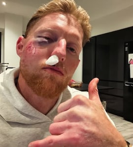 "Cricket Balls Do Serious Damage": Ben Stokes Vows To Always Wear Helmet After Facial Injury