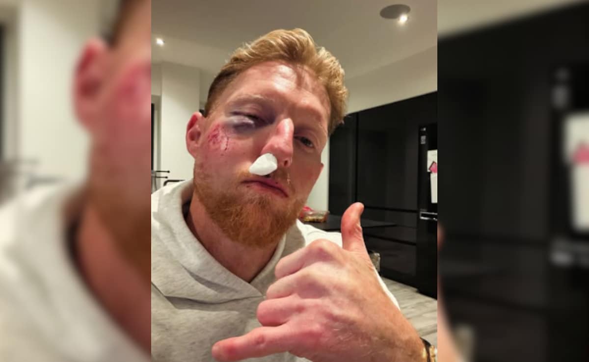 इंग्लैंड के टेस्ट कप्तान बेन स्टोक्स के चेहरे की सफल सर्जरी, गेंद लगने से हुए थे चोटिल