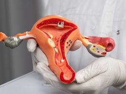 Can You Get Pregnant If You Have Endometriosis? Fertility Doctor Answers