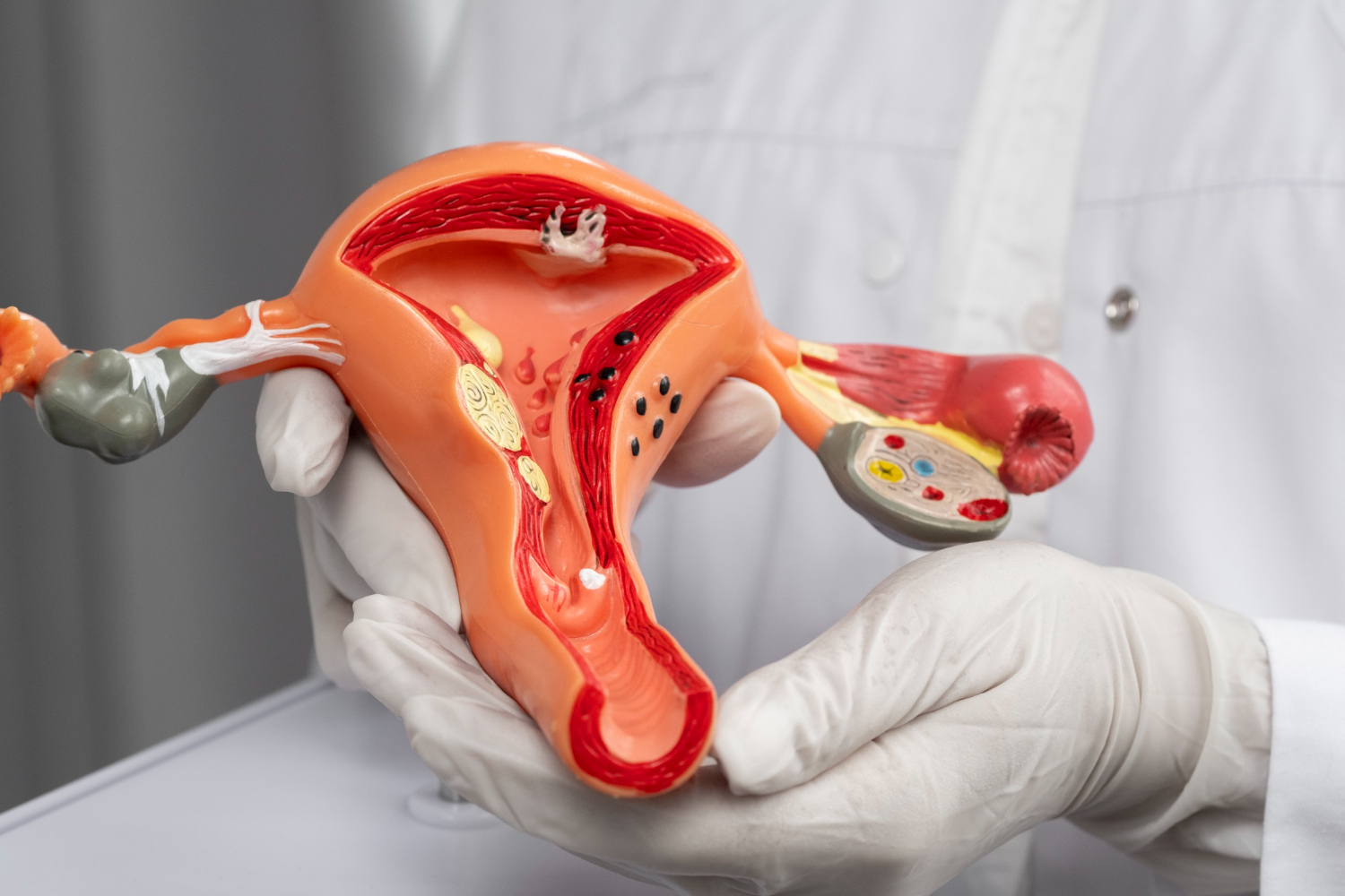 The relationship between endometriosis and fertility needs personal assessment