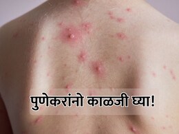 Pune News: पुणेकरांनो काळजी घ्या! 'चिकनपॉक्स'च्या साथीने नागरिक चिंतेत, रुग्णांमध्ये मोठी वाढ