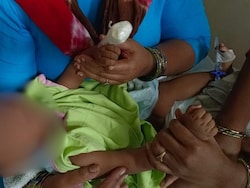 6-Month-Old Baby Loses Finger During IV Drip Removal In Bengaluru, Case Filed