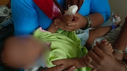 6-Month-Old Baby Loses Finger During IV Drip Removal In Bengaluru, Case Filed