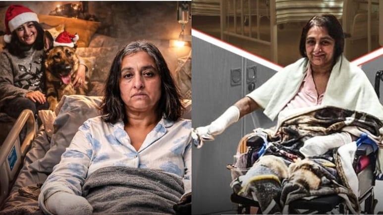 पालतू कुत्ते का प्यार बना जानलेवा, 6 बार रुका दिल...महिला के काटने पड़े हाथ-पांव