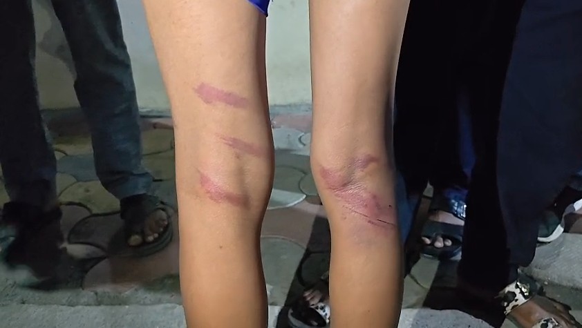 Maharashtra Teacher Assaults 30 Students Over Bent Motorcycle Number Plate