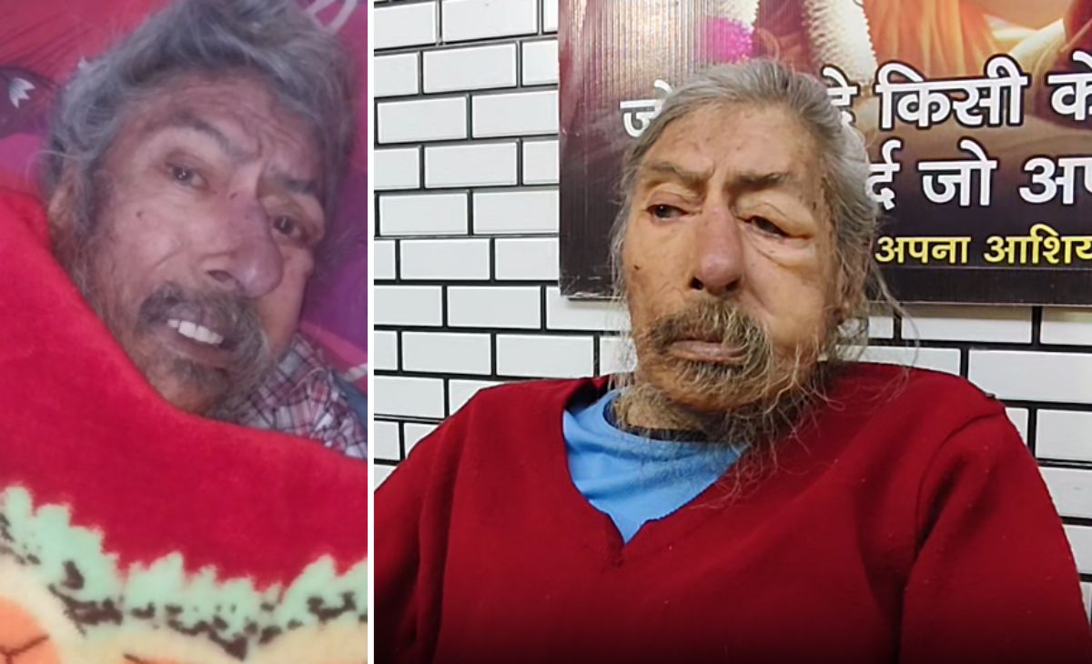 पत्नी, बेटा-बेटी विदेश में सेटल, डेढ़ साल से घर में अकेले रह रहे बुर्जुग डॉक्टर के शरीर पर चल रहे थे कीड़े