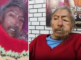 पत्नी, बेटा-बेटी ऑस्ट्रेलिया में सेटल, डेढ़ साल से घर में अकेले रह रहे बुर्जुग डॉक्टर के शरीर पर चल रहे थे कीडे़