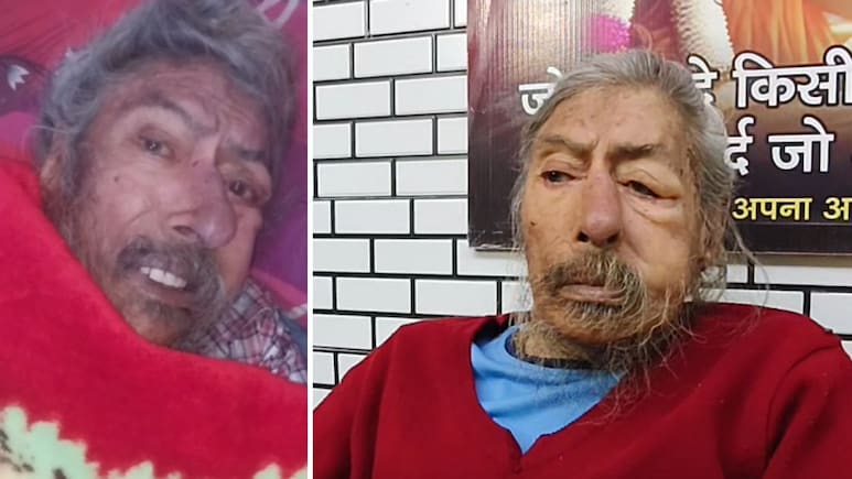 पत्नी, बेटा-बेटी ऑस्ट्रेलिया में सेटल, डेढ़ साल से घर में अकेले रह रहे बुर्जुग डॉक्टर के शरीर पर चल रहे थे कीडे़