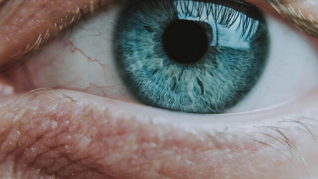 Peripheral Retina May Reveal Early Alzheimer's Before Brain Damage