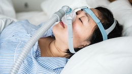 People With Obstructive Sleep Apnea Have 71% Higher Risk Of Heart Attacks, Stroke And Death: Study