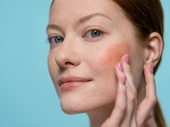 Nutritionist Shares 5 Easy Snacks That Can Help You Achieve Glowing Skin