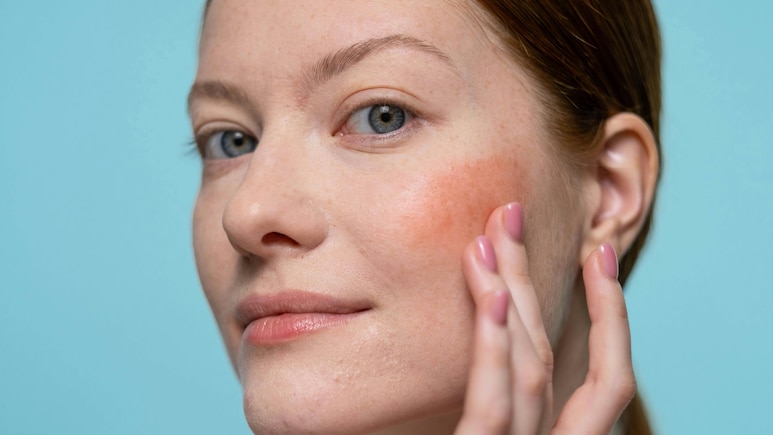 Nutritionist Shares 5 Easy Snacks That Can Help You Achieve Glowing Skin