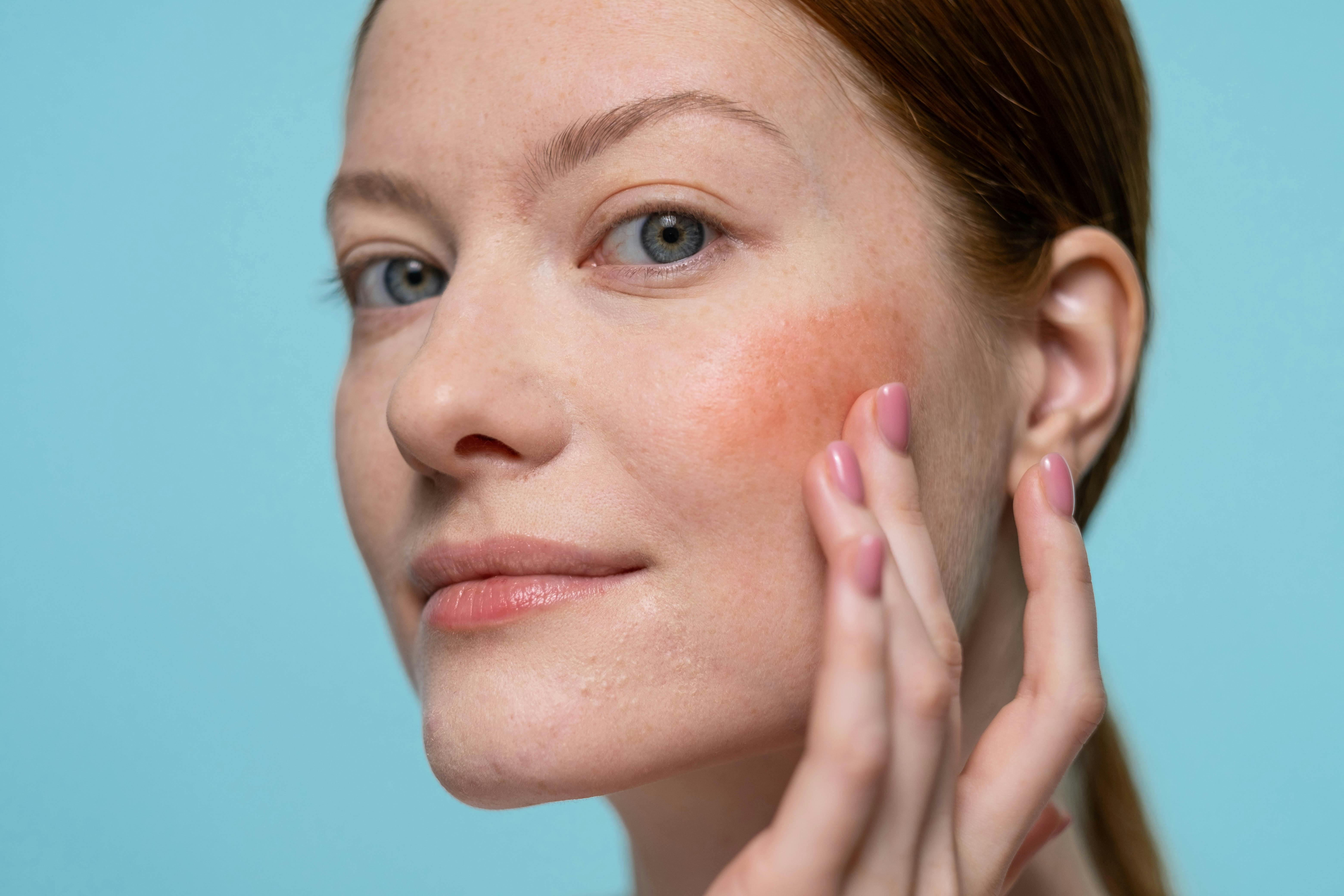 Nutritionist Shares 5 Easy Snacks That Can Help You Achieve Glowing Skin