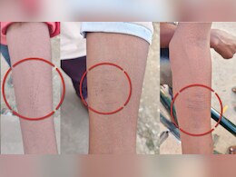 धमतरी के स्कूल में 30 से ज्यादा बच्चों ने खुद को ब्लेड से काटा, देखा देखी की ये हरकत या खतरनाक गेम!