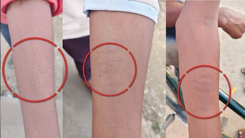 धमतरी के स्कूल में 30 से ज्यादा बच्चों ने खुद को ब्लेड से काटा, देखा देखी की ये हरकत या खतरनाक गेम!