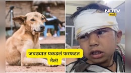 Shocking news: भटक्या कुत्र्यानं 4 वर्षाच्या मुलाला जबड्यात पकडलं, 100 मिटर फरफटत नेलं, पुढे जे घडलं ते ऐकून...