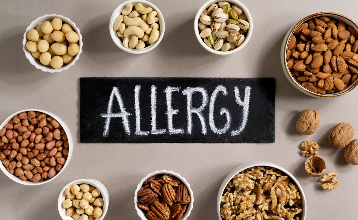 Food Allergies: 5 Early Warning Signs That You Need To Know